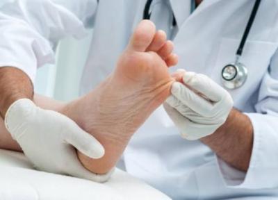 بیماری انگشت چکشی پا چیست و درمان آن چیست؟